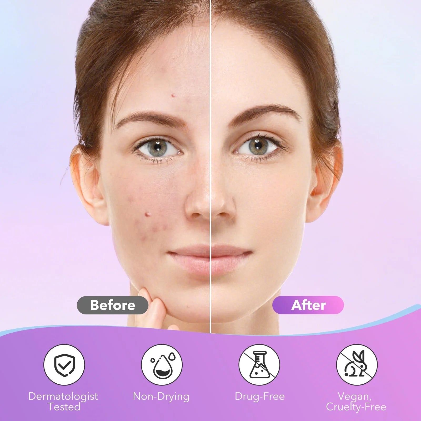 StarGlow Acne Patch Set